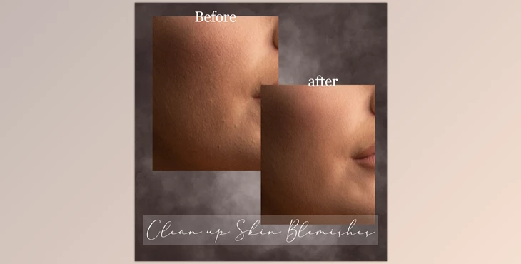 Download Sweet Soul Studio – Clean up Skin Blemishes