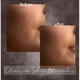Download Sweet Soul Studio – Clean up Skin Blemishes
