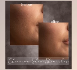Download Sweet Soul Studio – Clean up Skin Blemishes