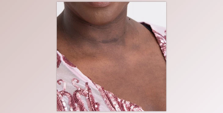 Download The Portrait Masters – The Retouching Series: Blotchy Skin