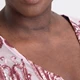 Download The Portrait Masters – The Retouching Series: Blotchy Skin