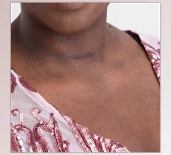 Download The Portrait Masters – The Retouching Series: Blotchy Skin