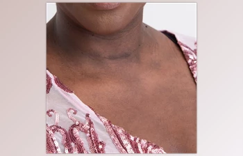 Download The Portrait Masters – The Retouching Series: <span class='badge badge-warning'>Blotchy</span> Skin