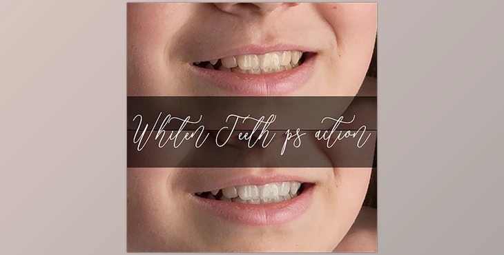Download Sweet Soul Studio – Whiten Teeth Action