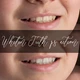 Download Sweet Soul Studio – Whiten Teeth Action