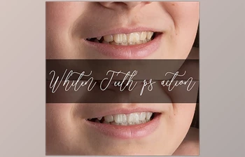 Download <span class='badge badge-warning'>Sweet</span> <span class='badge badge-warning'>Soul</span> Studio – Whiten Teeth Action